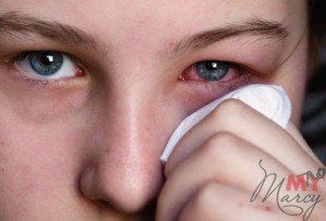 Любые глазные болезни – прямое противопоказания к наращиванию ресниц