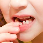 Почему не выпадают молочные зубы
