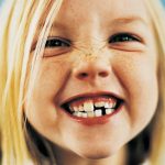 Реставрация молочных зубов у детей