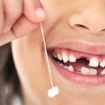 Как вырвать молочный зуб: домашнее удаление или визит к стоматологу