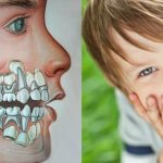 Как выглядит череп ребенка до выпадения молочных зубов