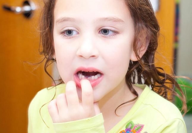 Шатающийся молочный зуб часто вызывает дискомфорт у ребенка (фото: care.com)