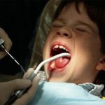 Все плюсы и минусы серебрения молочных зубов